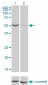 PGM1 Antibody (monoclonal) (M01)